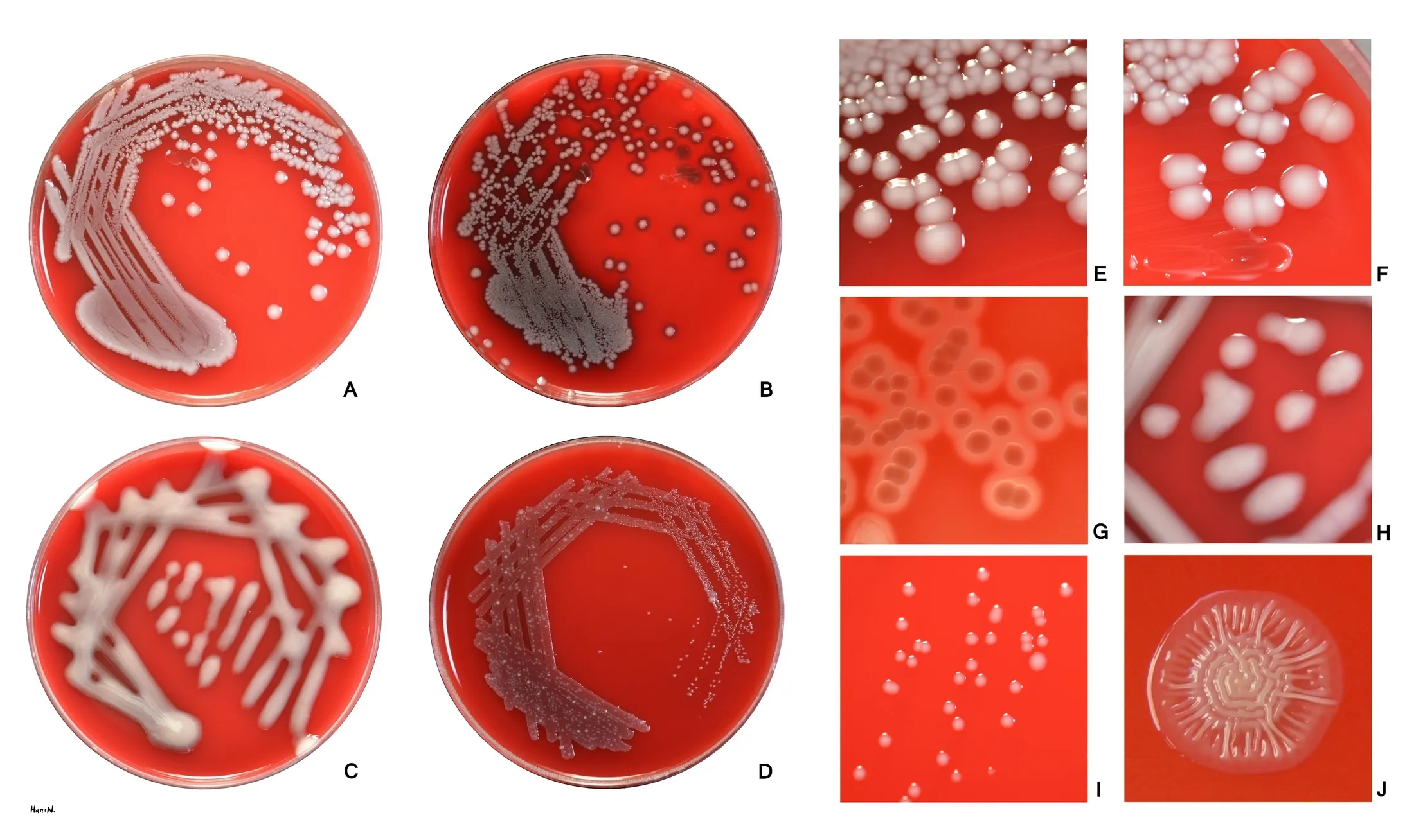 Four sheep blood agar plates and six close-up views showing varied E. coli colony shapes and textures.