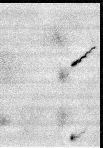 Microscopy showing an Escherichia coli cell swimming and tumbling.